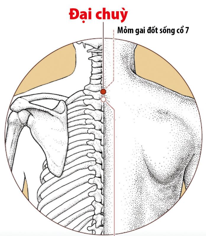 Các huyệt đạo chính để điều trị đau vai gáy